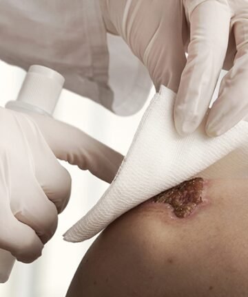 Wounds